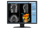 Monitor - 21" EIZO RadiForce MX217-SB - 1200x1600 - IPS - MX217-SB