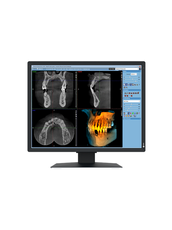 21 EIZO RadiForce MX217-SB - 1200x1600 - IPS
